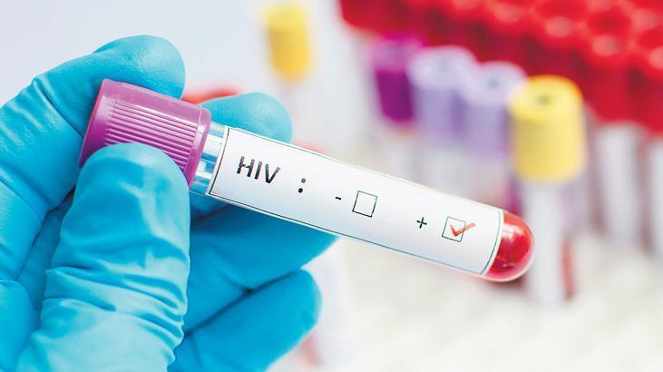 Dünya ve Türkiye AIDS Gününe Giriş: HIV ile Yaşamanın Güncelliği ve Toplumsal Etkileri