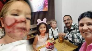 Etimesgut’ta Pitbull Olayı: Aile İçi Tartışma ve Saldırıların Ardındaki İfadeler