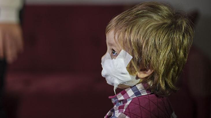 Etimesgut’ta Pitbull Saldırısı: Efe Öztürk’ün Evde Tedavisi Devam Ediyor