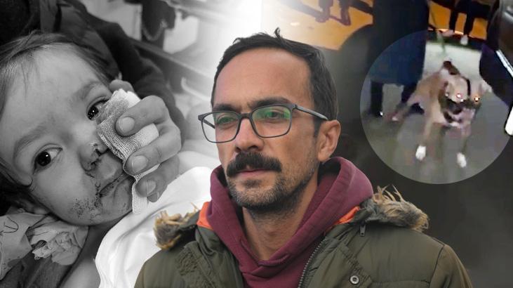 Etimesgut’ta Pitbull Saldırısı: Heye Şikayetler ve Sorumluluklar Üzerine