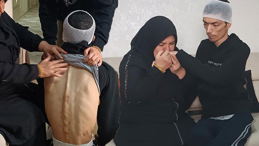 Gaziantep’te Bakım Merkezinde Şiddet İddiası: Oğlunu Gördüğünde İçinin Parçalandığını Söyledi