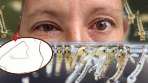 Göz Kapağı Altında Gözlenen Sırlar: Dirofilaria Repens Vakası ve Avrupa’daki Artış