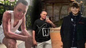 Hamidiye Mahallesi’nde Çaydanlık Yangını ve Buzdolabına Sıçrayan Alevler: Genç Yaralı Olayın Ayrıntıları