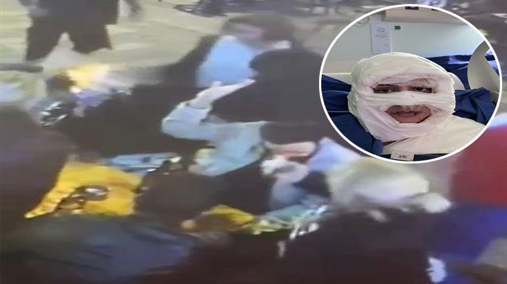 Kadıköy’de Saldırı: Yanıcı Maddeyle Üzerine Dökülen Kadına Dair Gelişmeler