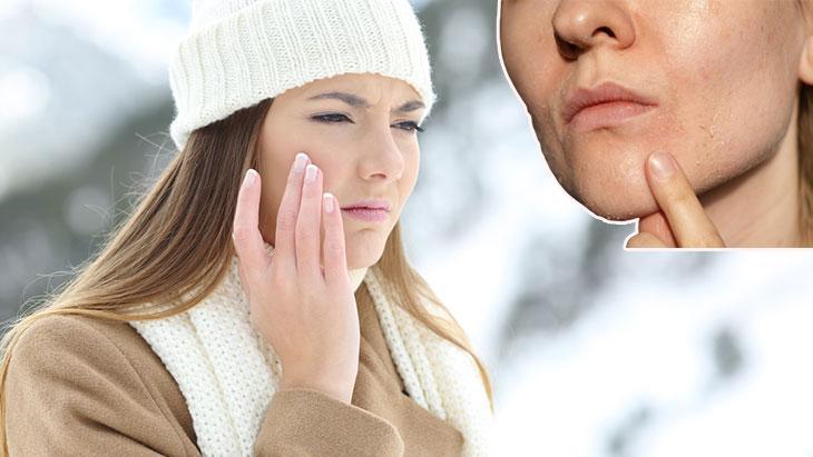 Kış Aylarında Cilt Bariyerini Korumak İçin Pratik Bakım Rehberi
