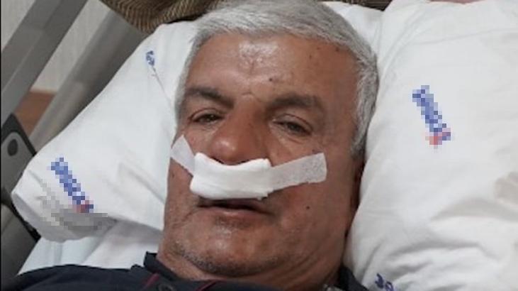 Salih Müldür’ün Burun Operasyonu: Beton Benzeri Doku Parçalanıp Çıkarıldı