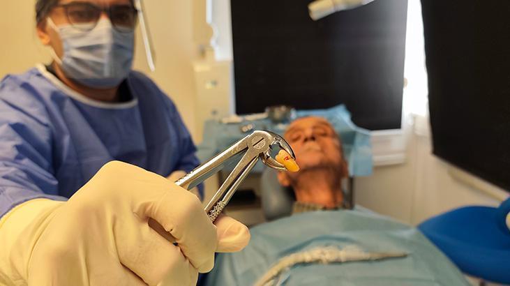 Uzman Doktorun Uyarısı: 20’lik Dişler Her Yaşta Sorun Yaratabilir ve Protezle İlişkisi