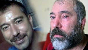 Adana’da Durağın Gergin Anı: Şoföre Yönelik Bıçak ve Göz Kaybı Soruşturması