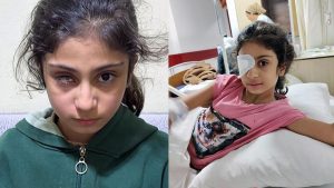 Gözlükteki Kusur ve Göz Kaybı Davası: Ailenin İddiaları ve Hekimlik Sorumluluğu