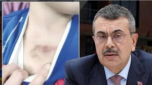 Kütahya Ziyaretinde Eğitim ve Hukuk Devleti Vurgusu: Tekin’den Stratejik İş Birliği ve Kreş Tartışmaları