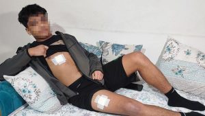 Seyhan’da Parkta Bıçaklı Saldırı: Akran Zorbalığı ve Tutuklama Girişimleri