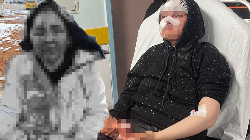 Şiddet Olayında Boşanma Göndermesiyle Gelişen Olayda Şüphelinin Şok Eylemi
