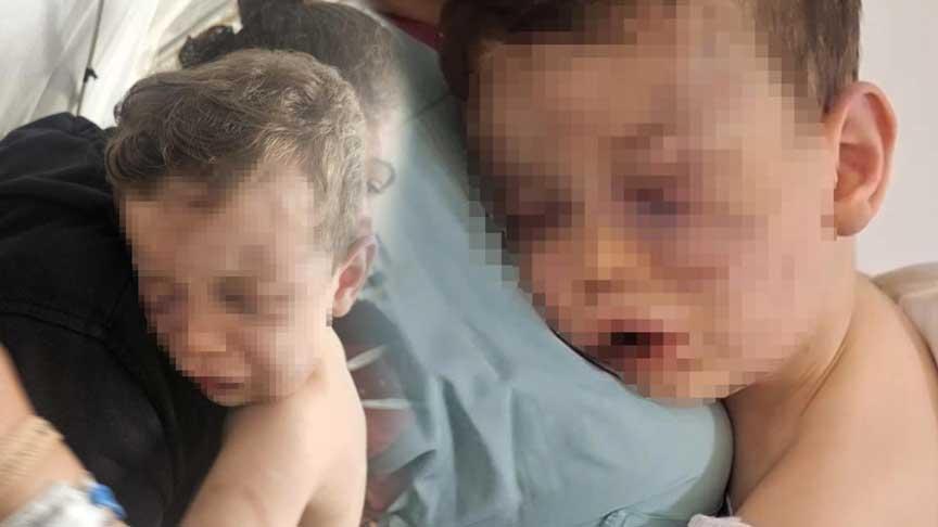 Ailesel Şiddet Vakası: Çocukta Kırık ve Görme Kaybı Tehlikesiyle Devam Eden Olaylar