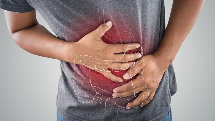 Crohn Hastalığında Alevlenme Dönemleri ve Kontrol Altına Alma Stratejileri