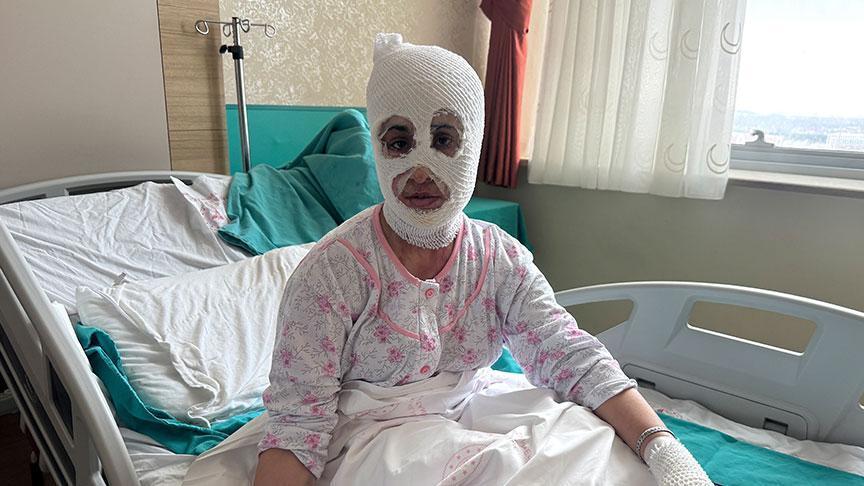 Yanık Olayı: Düdüklü Tencere Patlaması ve Sonrası Yaşananlar