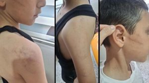 Manisa’da Aile İçi Şiddet Olayı: Oğul Darbedildi, Anne Devlet Korumasında