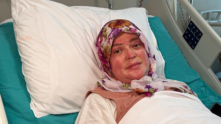 Karavanda Yaşanan Yangında Aileye Yönelik Yoğun Tedavi ve Gaz Kaçağı Uyarısı