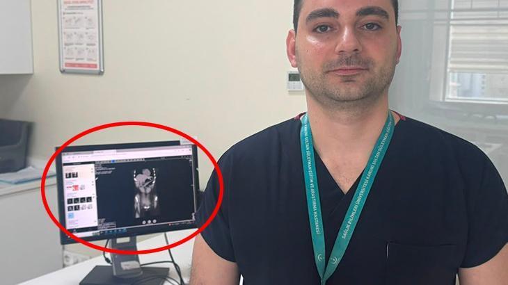 Kilo Vermeye Çalışırken Kendini Kusturmaya Çalışan Kişinin Yanıltıcı Yutması: 13 Santimetrelik Fırça Midesinde