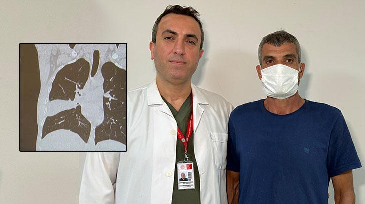 Kemiğe Bağlı Gizemli Lezyon: VATS ile Başarılı Bir Müdahale ve Yabancı Cisim Uygulaması