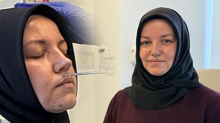 Beyin Omurilik Sıvısı Kaçaklarını Travma Sonrası Endoskopik Müdahale ile Tedavi eden Başarılı Bir Hikaye